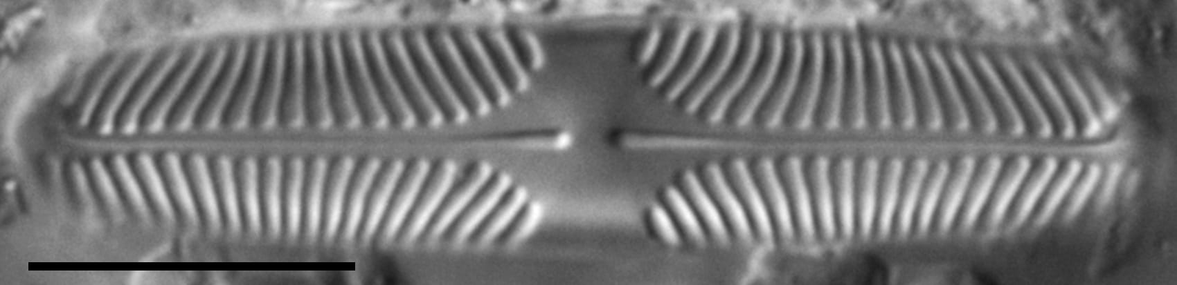 Pinnularia lacunicola LM4