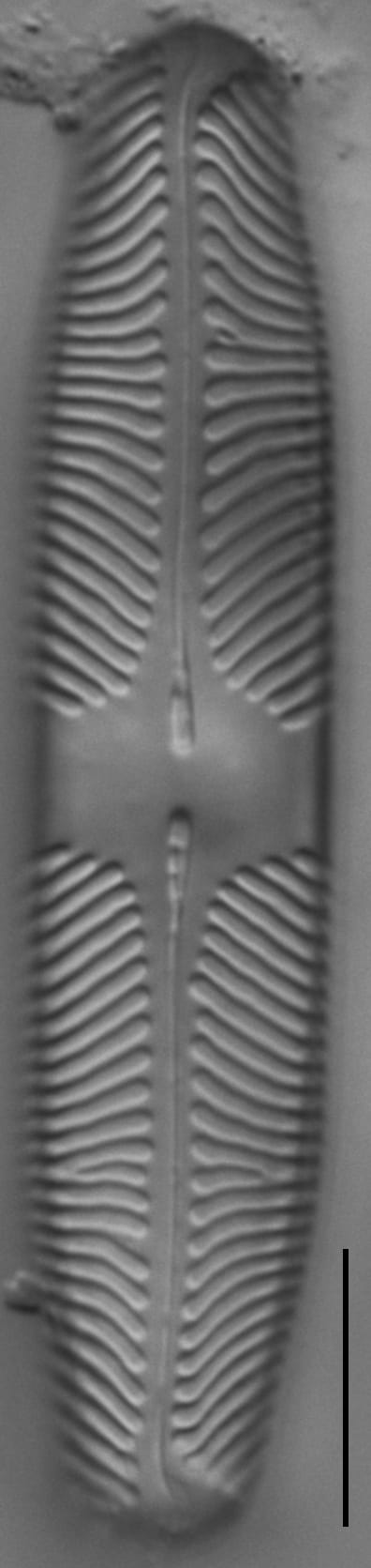 Pinnularia lacunicola LM5