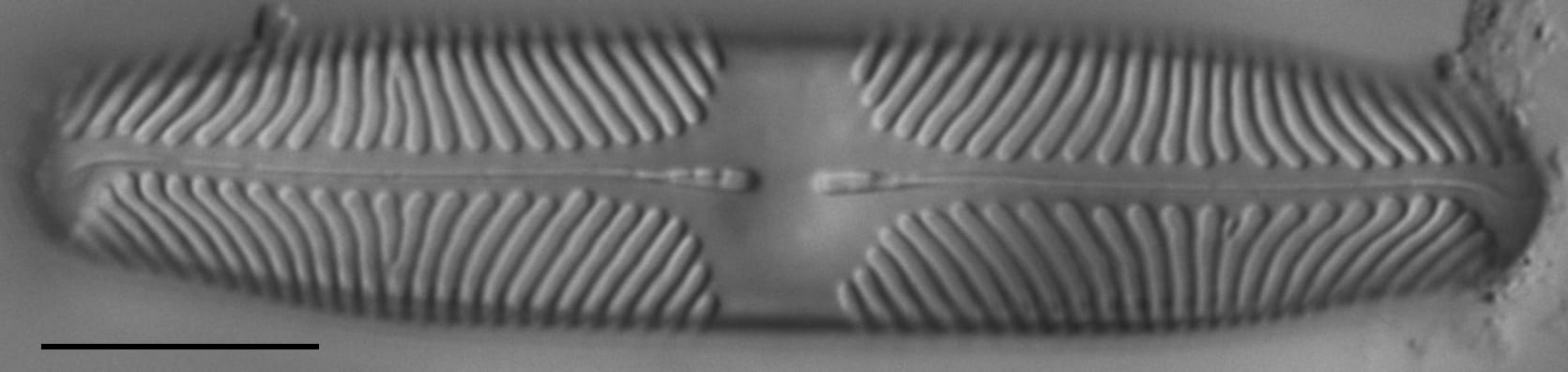 Pinnularia lacunicola LM5