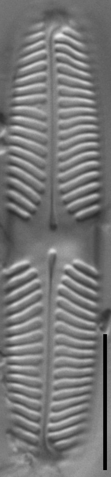 Pinnularia lacunicola LM7