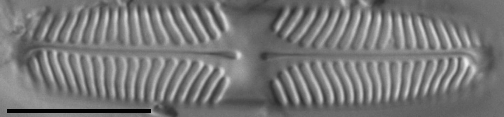 Pinnularia lacunicola LM7