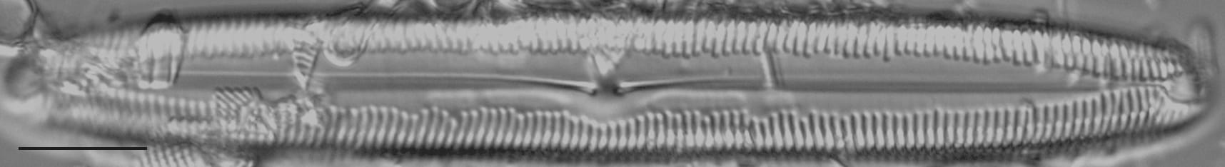 Pinnularia kwacksii LM5