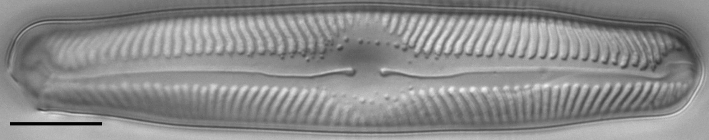 Pinnularia lailaensis LM4