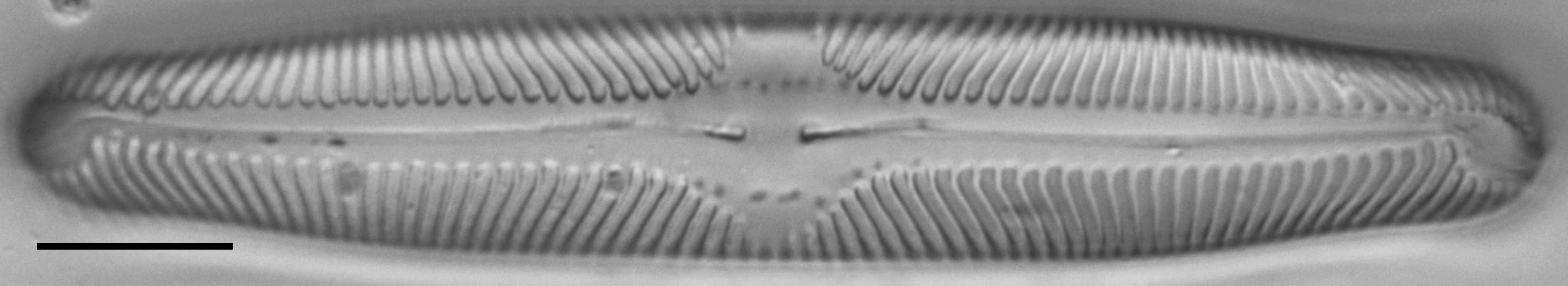 Pinnularia lailaensis LM5