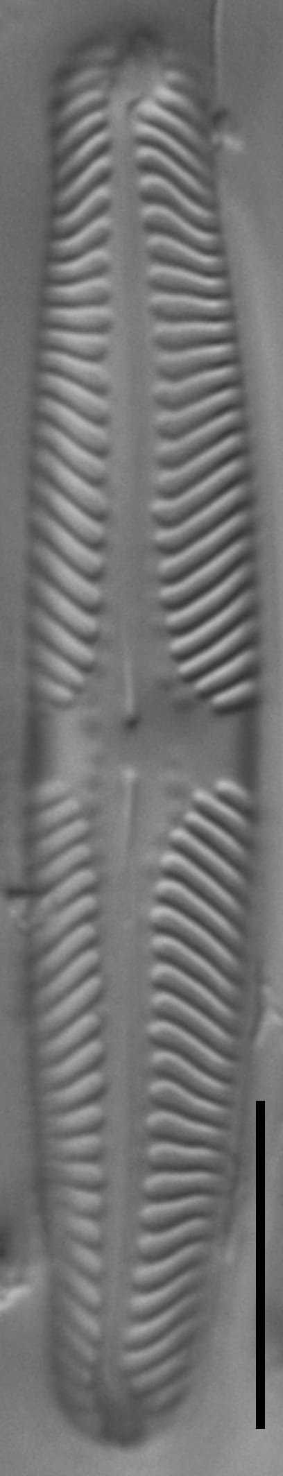 Pinnularia lunata LM5