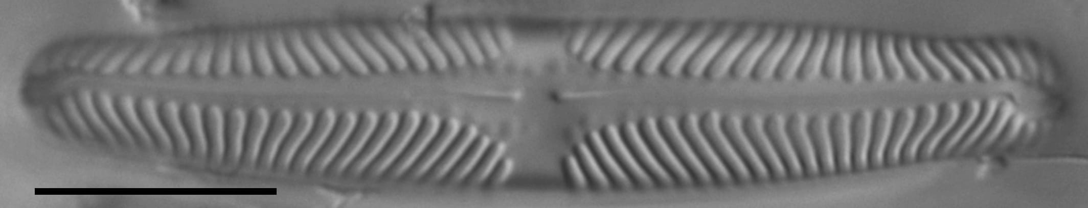 Pinnularia lunata LM5