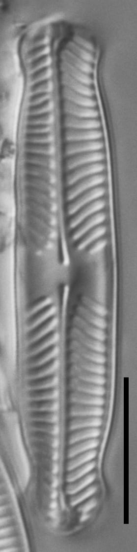 Pinnularia perinterrupta LM1
