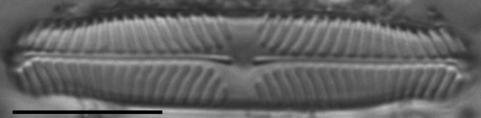 Pinnularia perinterrupta LM4