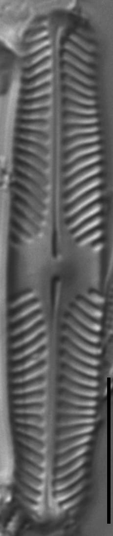 Pinnularia perinterrupta LM5