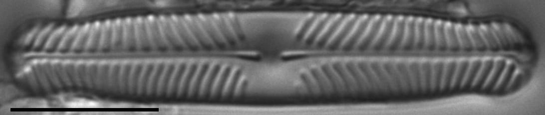 Pinnularia perinterrupta LM7