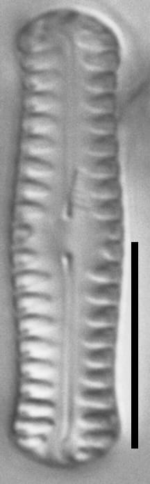 Pinnularia pseudoparva LM2