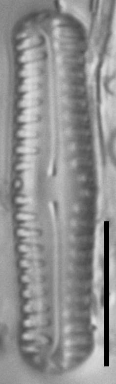 Pinnularia pseudoparva LM5