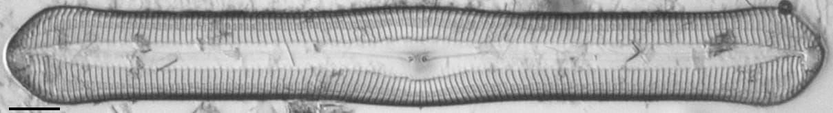 Pinnularia rexlowei LM5