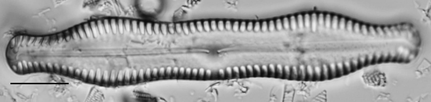 Pinnularia scotica LM2