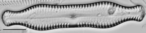 Pinnularia scotica LM1