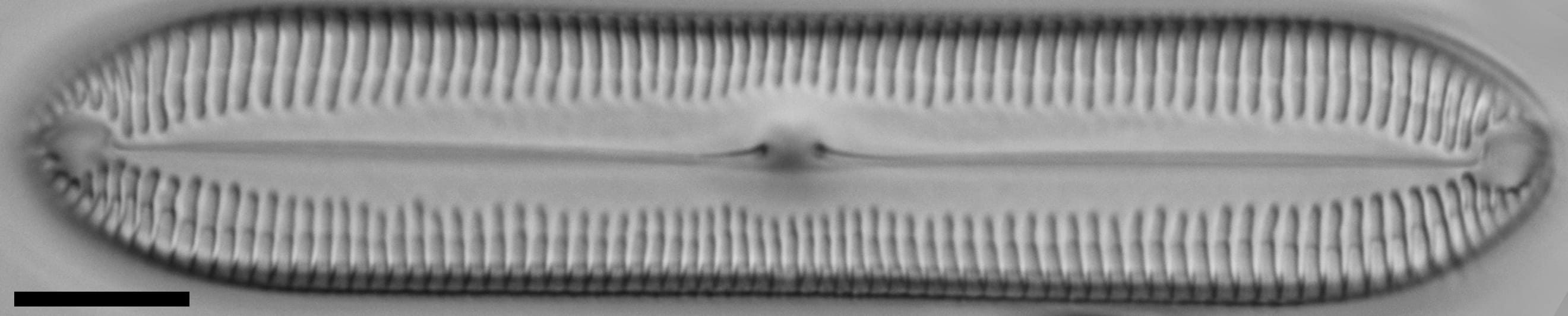 Pinnularia socialis LM1