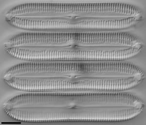 Pinnularia socialis LM4