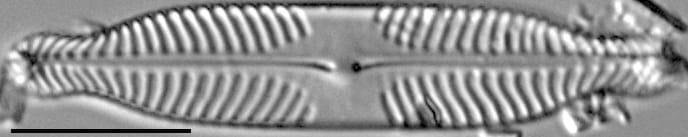 Pinnularia subanglica ANSP GC57554 03