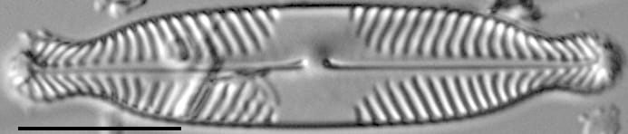 Pinnularia subanglica ANSP GC57554 04