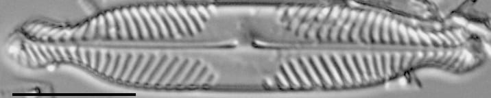 Pinnularia subanglica ANSP GC57554 06