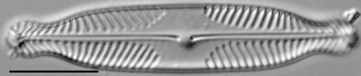 Pinnularia subanglica ANSP GC57554 07