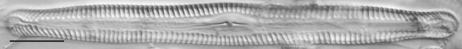 Pinnularia feremorosa LM1