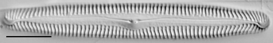 Pinnularia feremorosa LM2