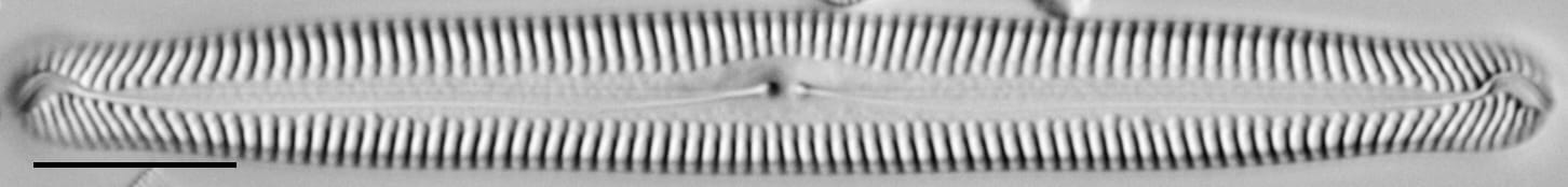 Pinnularia feremorosa LM3