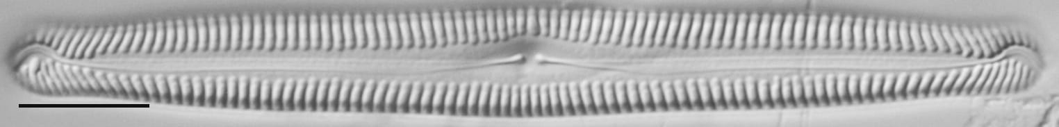 Pinnularia feremorosa LM5