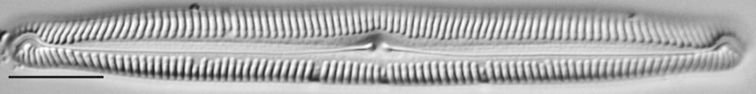 Pinnularia feremorosa LM7