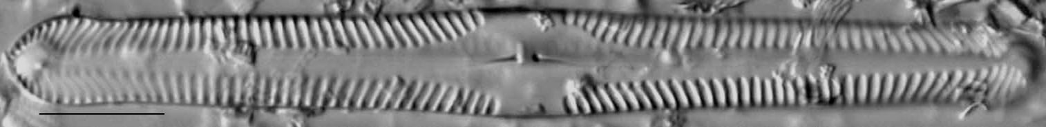 Pinnularia subgibba var undulata LM6