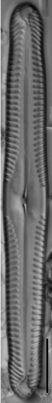 Pinnularia subgibba var undulata LM5