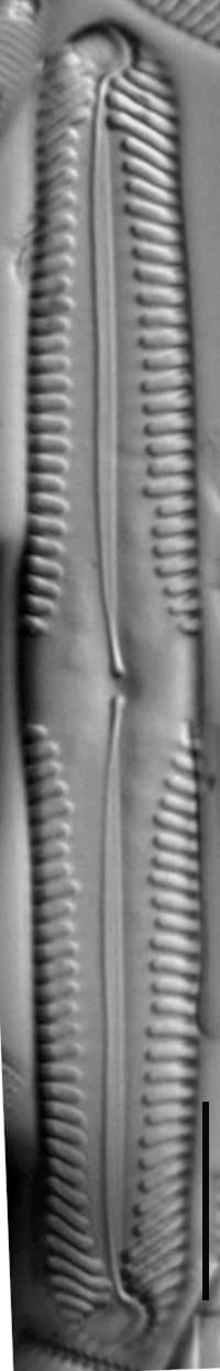 Pinnularia subgibba var undulata LM2