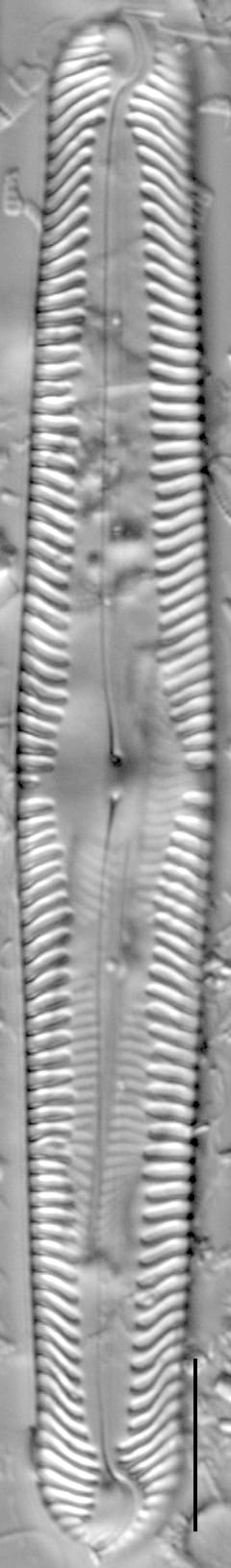 Pinnularia subgibba LM1