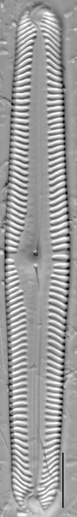 Pinnularia subgibba LM2