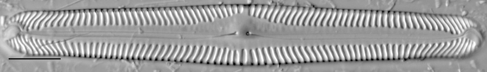 Pinnularia subgibba LM2
