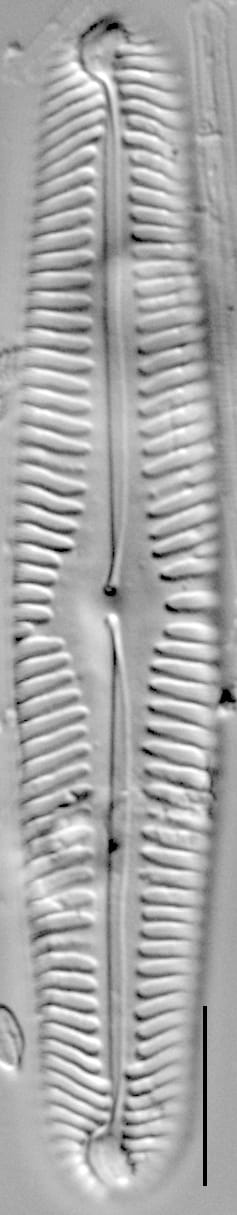 Pinnularia subgibba LM3