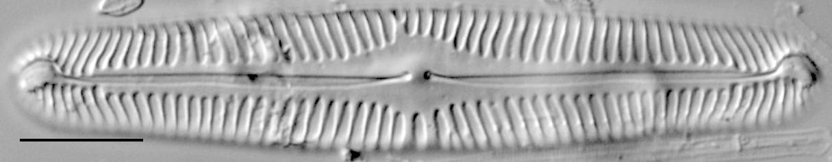 Pinnularia subgibba LM3