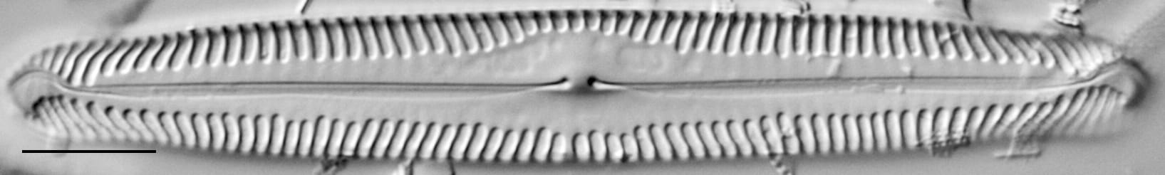 Pinnularia subgibba LM5