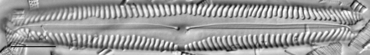 Pinnularia subgibba LM6