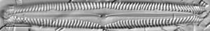 Pinnularia subgibba LM6