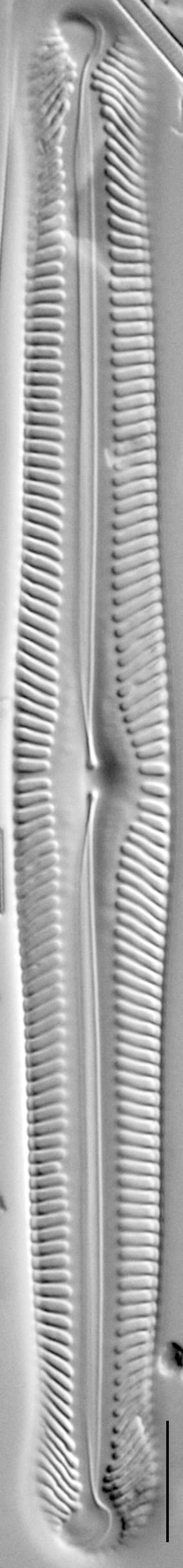 Pinnularia subgibba LM7