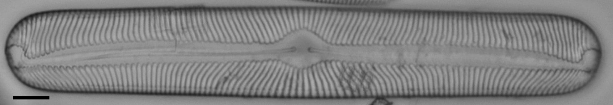 Pinnularia torta LM6