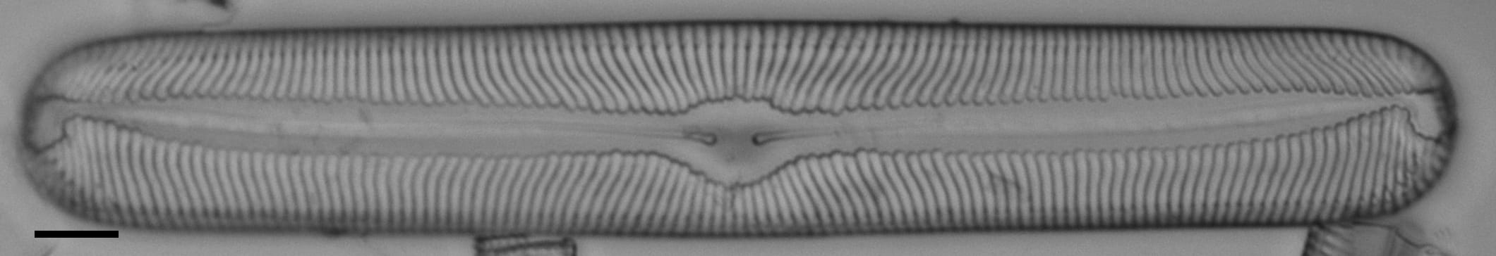 Pinnularia torta LM5