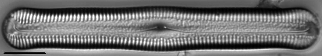 Pinnularia acrosphaeria LM7