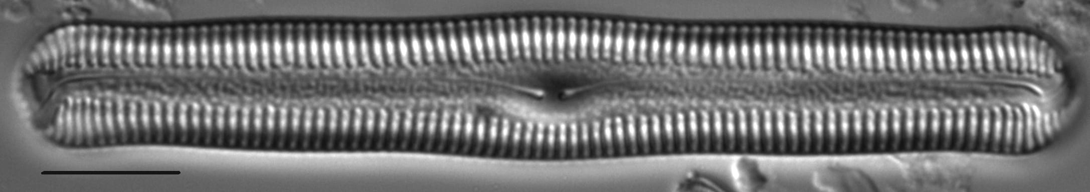 Pinnularia acrosphaeria LM6