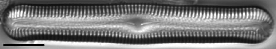 Pinnularia acrosphaeria LM4