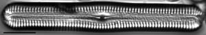 Pinnularia acrosphaeria LM3