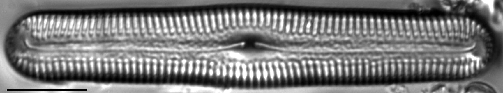 Pinnularia acrosphaeria LM2