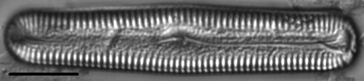 Pinnularia acrosphaeria LM1